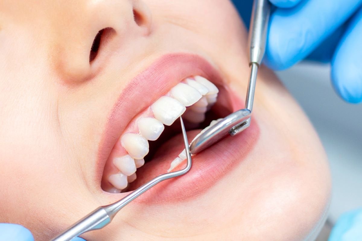 habitudes alimentaires saines pour les dents